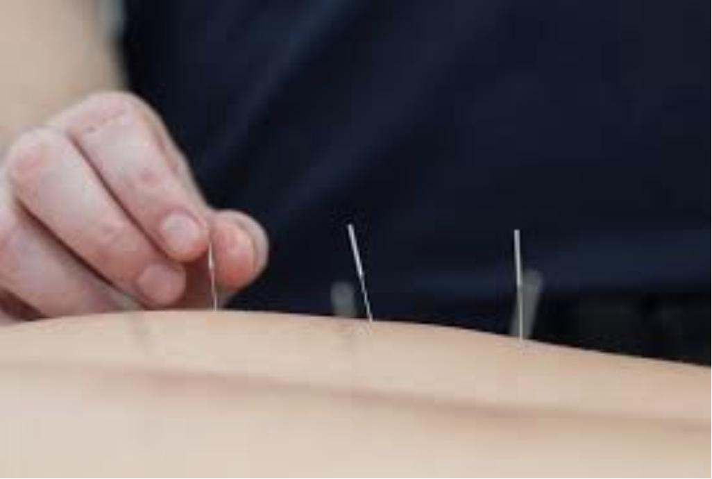 using acupuncture to relieve constipation
